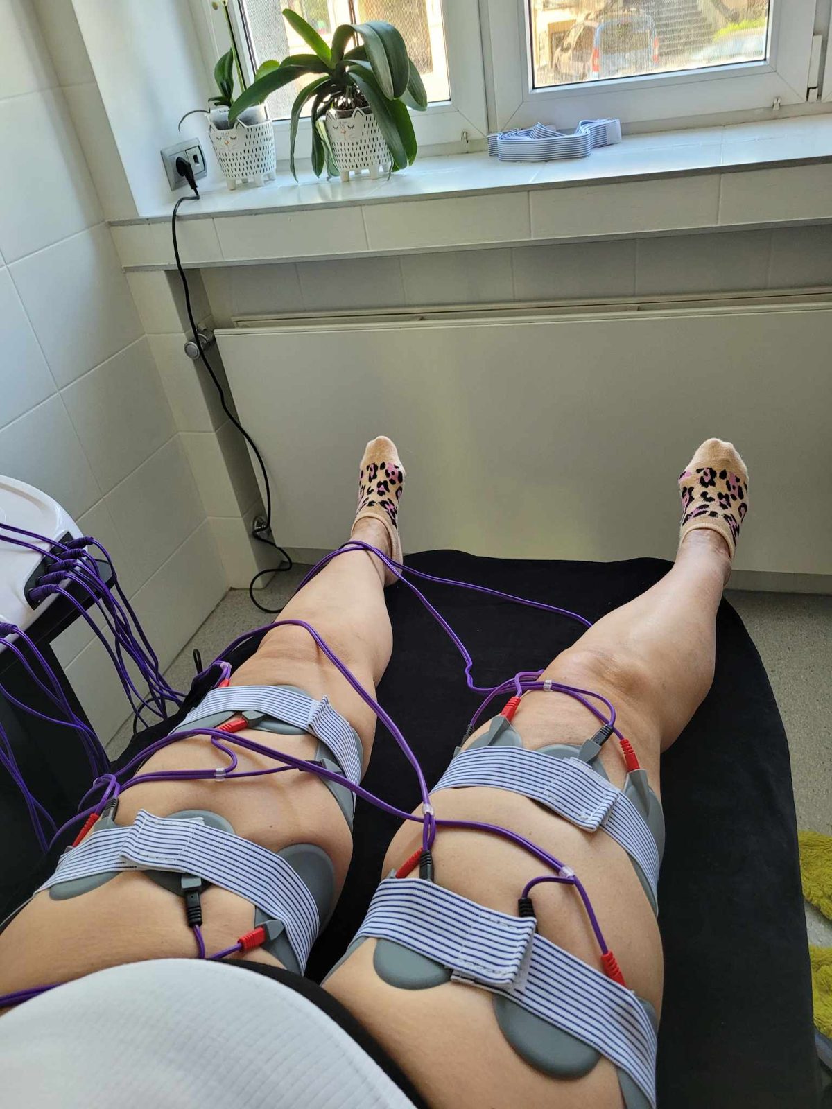 Elektrody EMS na udach pacjentki, bez twarzy